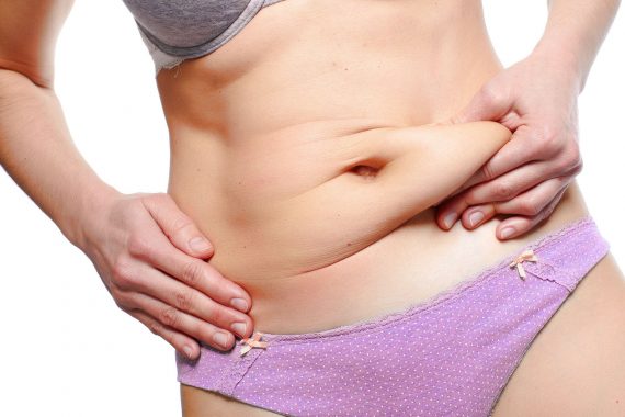 Tummy Tuck Surgery